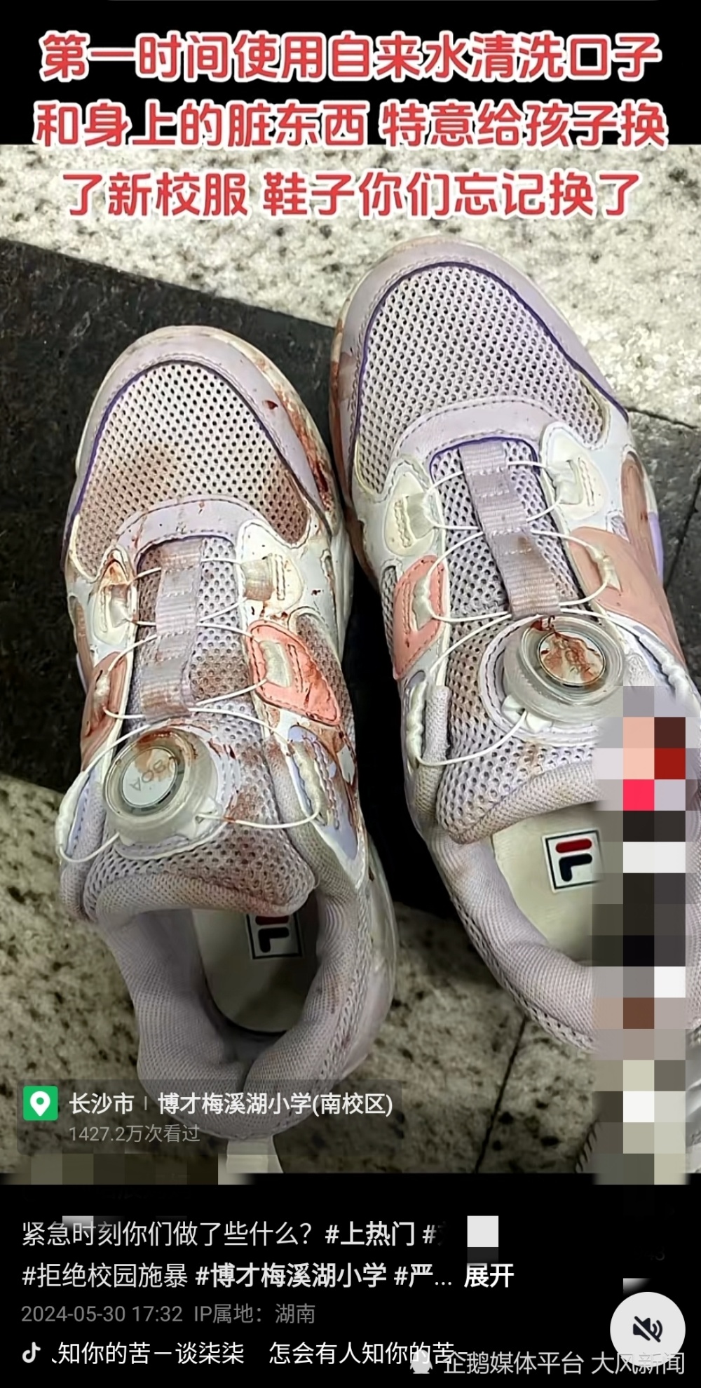 天顺平台注册：9岁女生被老师投掷三角尺嵌入头部，治疗一年后遗症严重，案件将开庭